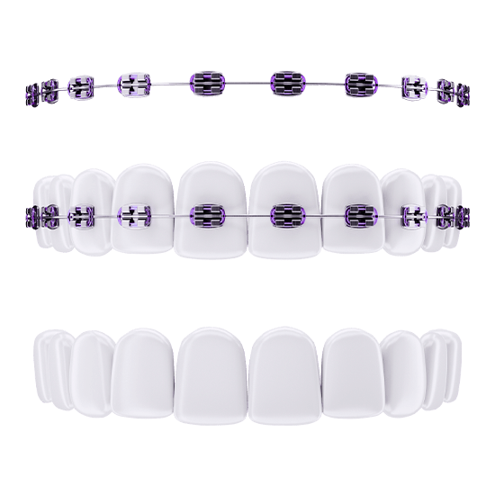 Ортодонтия